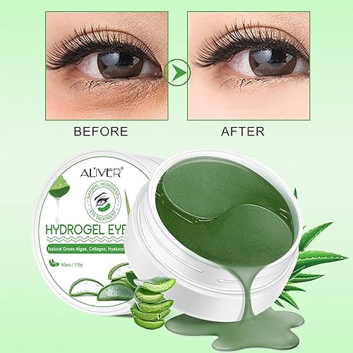 Miniatura 2 de ZODENIS Parches para debajo de los ojos, 30 pares, máscara de colágeno para ojeras, ojos hinchados, tratamiento de arrugas, bolsas de aloe con ácido