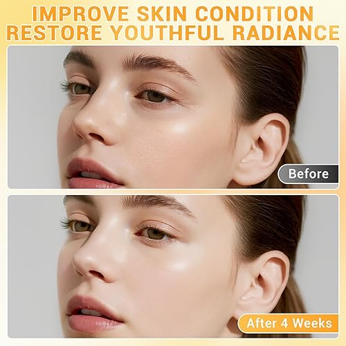 Miniatura 3 de Suero de vitamina C al 23% para cara, fórmula hidratante y mejora la piel con vitamina E y ácido hialurónico, suero de vitamina C para líneas finas