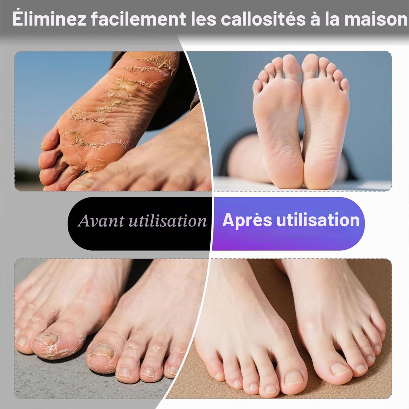 Mielle Glow Pied Râpe Électrique Pieds Pédicure Compatible avec Soin Talons