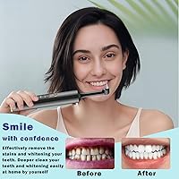 Vista 7 de Pulidor de dientes recargable con 5 cabezales de cepillo, 9 pastas de pulido, 4 modos de velocidad, kit de limpieza dental IPX6, luz LED, kit