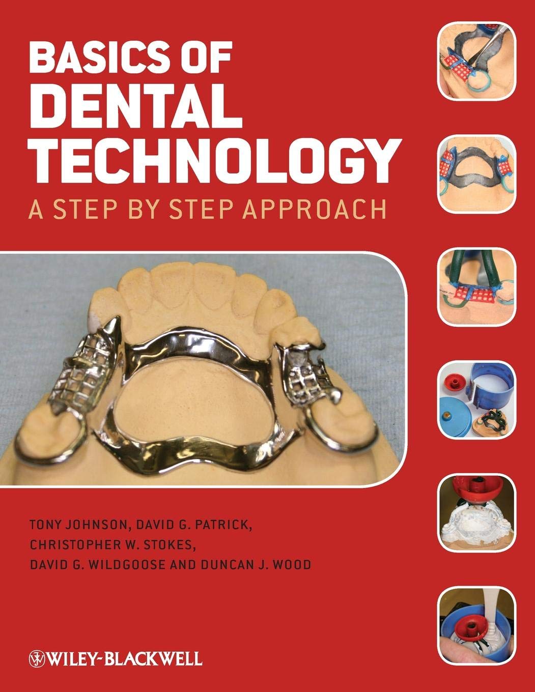 Basics of Dental Technology: A Step by Step Approach Paperback – 19 November 2010