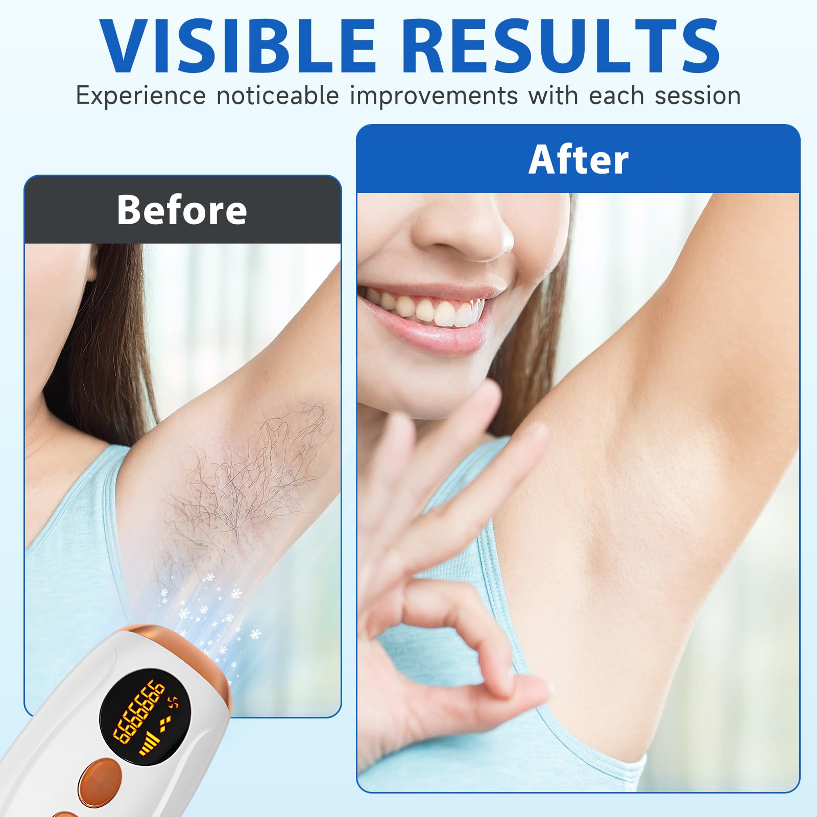Depiladora Luz Pulsada IPL, Depiladora Luz Pulsada con Función de Enfriamiento, 500.000 Flashes, 5 Niveles de Energía, Depilación Láser Indolora para Mujer y Hombre, Cara, Cuerpo, Axilas, Bikini