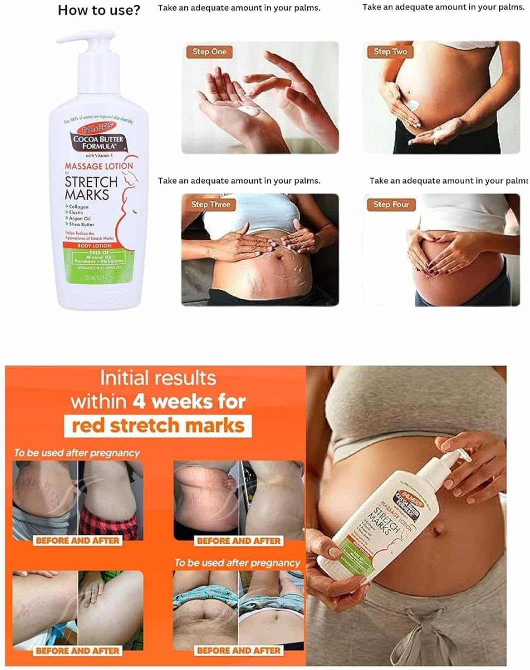 Palmers Stretch Mark Lotion 250ml, Cocoa Butter Formula, Advanced Massage Lotion designed to remove stretch marks, Pregnancy Treatment provides intense hydration, leaving skin smooth and supple