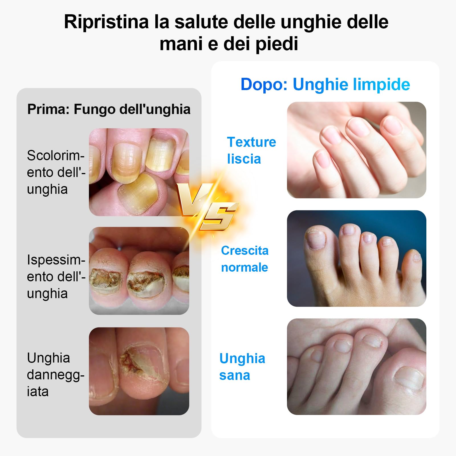 Dispositivo Unghie LED, 500nm Blu & 940nm Rosso, 26 LED Ricaricabile | 26 LED luce blu 500nm & rossa 940nm, timer integrato. Per unghie mani e piedi, facile uso domestico.