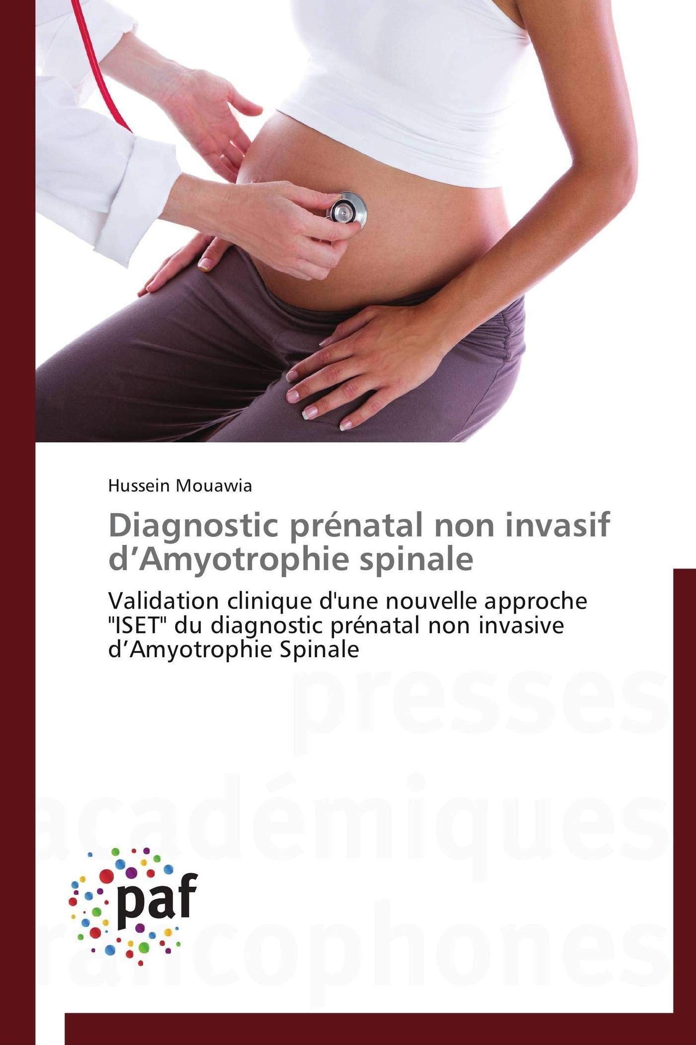 Diagnostic prénatal non invasif d’Amyotrophie spinale: Validation clinique d'une nouvelle approche "ISET" du diagnostic prénatal non invasive d’Amyotrophie Spinale