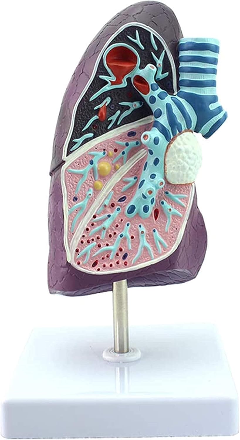 Amazon.com: Teaching Model Anatomy Model, Lung Anatomical Model - Human ...
