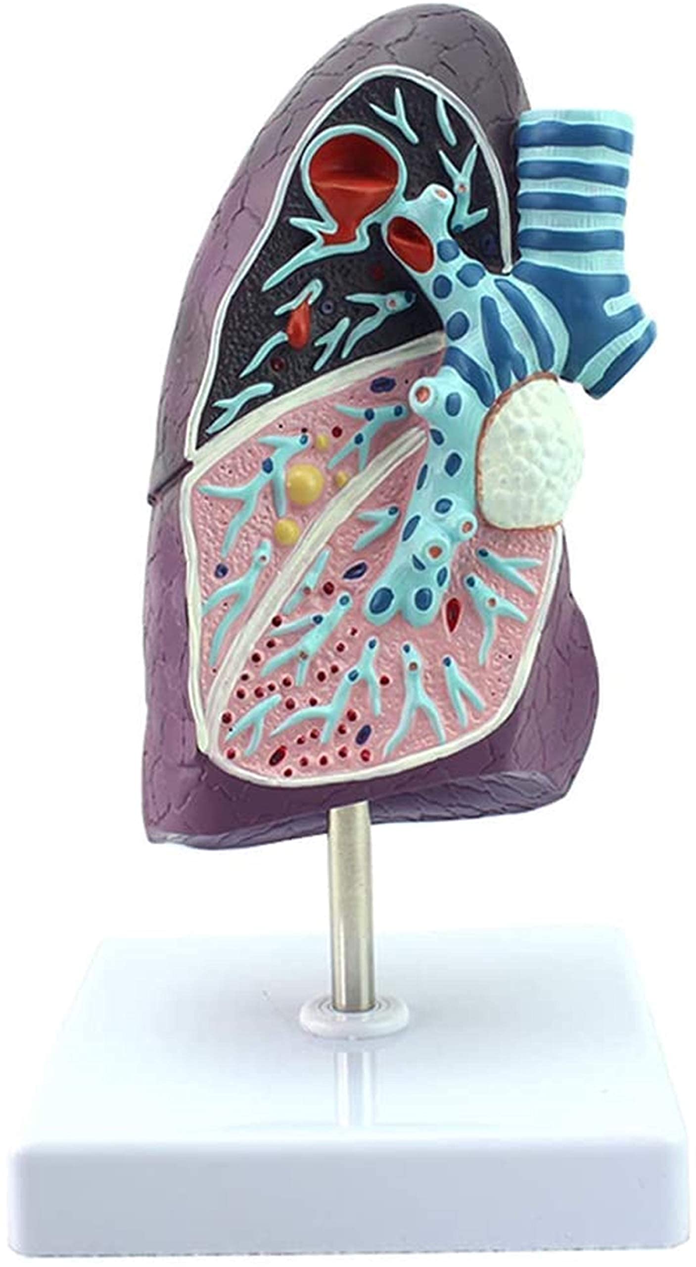 GTHTUHFD Anatomy Model, Lung Model - Human Organ - Smoker'S Pathological Tuberculosis Pneumonia Thoracic Surgery Respiratory Model - Human Science Models For Medical Skeleton