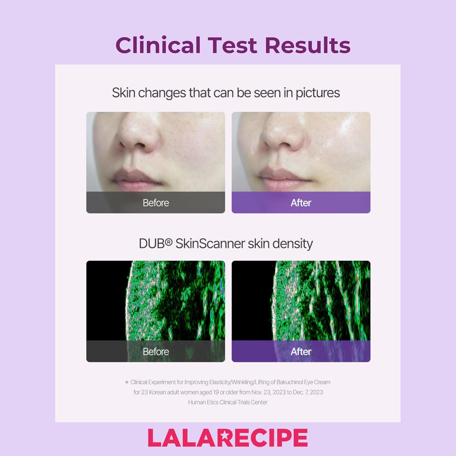 LALARECIPE Bakuchiol First Essence – Hydrating Milky Korean Toner with Retinol Liposome, Shea Butter & Peptides – Vegan Skincare for Wrinkle Care & Elasticity (5.24 fl oz) - Image 5