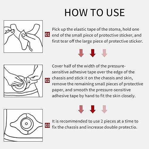 Miniatura 6 de Tiras de barrera de ostomía para bolsas de colostomía, tiras adhesivas de barrera en forma de Y, paquete de 20, extensor de barrera de suministros