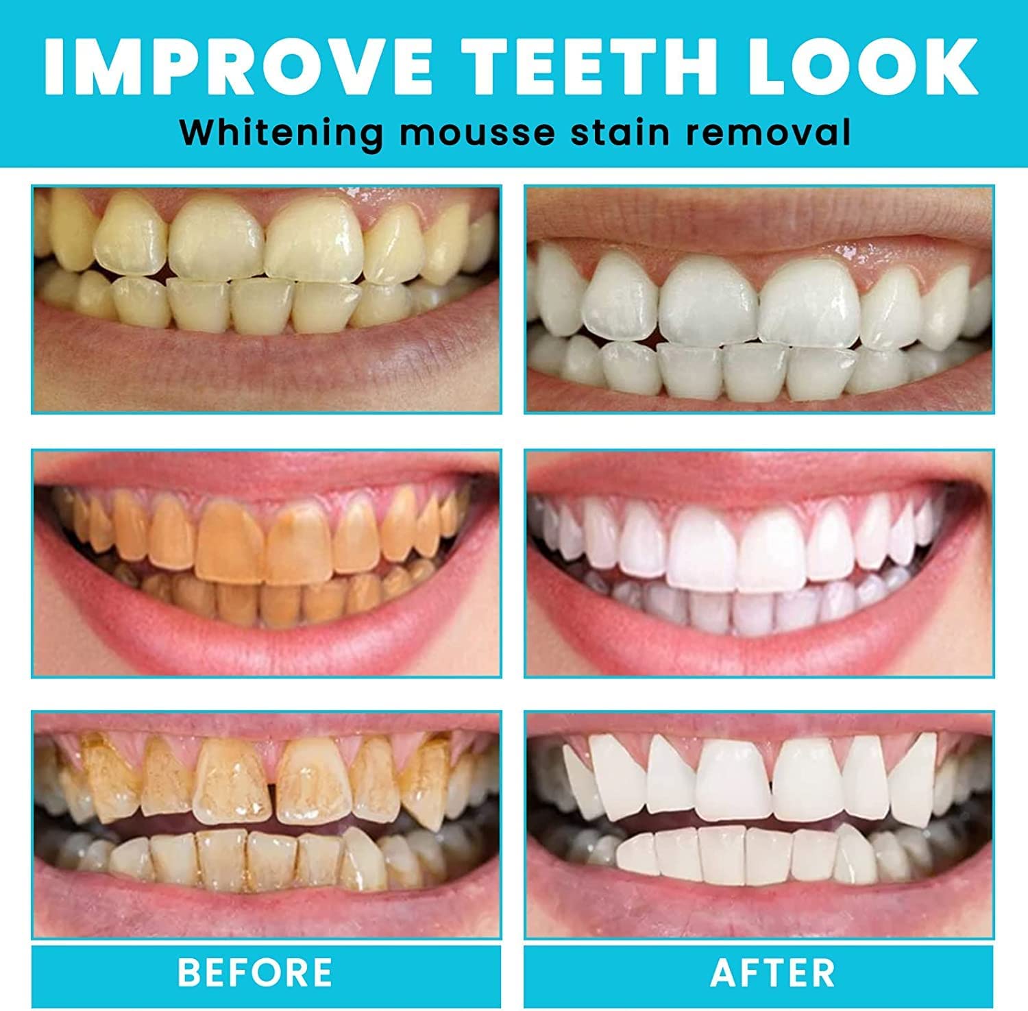 2 Pcs Teethaid Mouthwash, Calculus Removal, Teeth Whitening, Healing Mouth, Nature Teeth Whitening Foam Toothpaste, Stain Removal, Oral Care,natural Mouth Wash Water