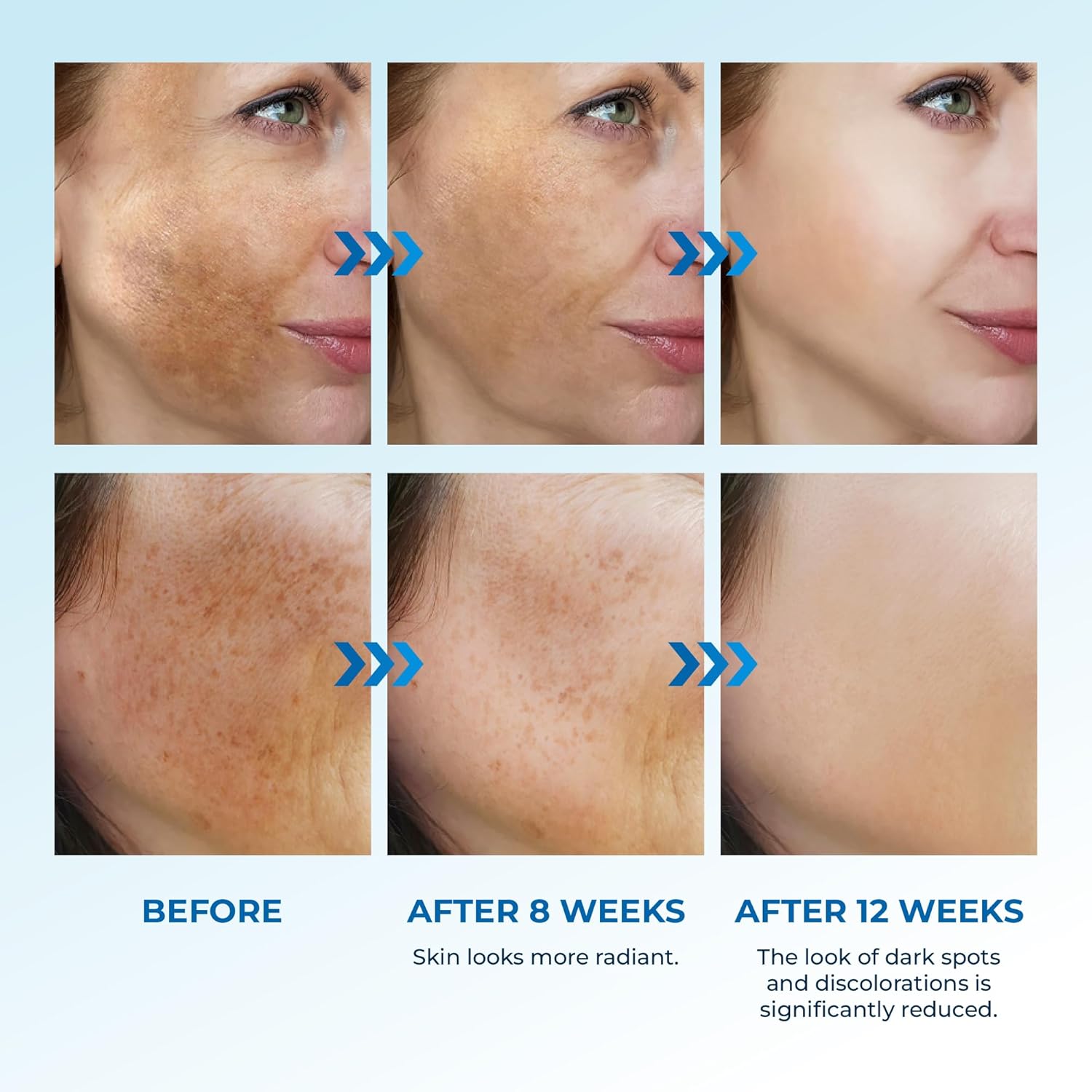 Abera Dark Spot Serum for Face, Dark Spot Corrector, Melasma & Age Spot Treatment, Boost Moisturization & Pore Minimize, All Skin Types, 0.68 fl Oz - Image 5