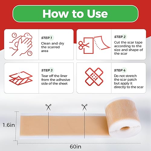 Miniatura 6 de Hojas de silicona para cicatrices, rollo de cinta de silicona para cicatrices (rollo de 1.6 x 60 pulgadas - 4.9 ft), tiras de cicatriz de silicona