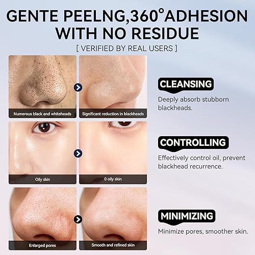Miniatura 3 de LANBENA Kit de eliminación de puntos negros 3 en 1, tiras de poros de nariz de 1.06 oz+suero de poros de 1.0 fl oz+ papel de tira, máscara removedor