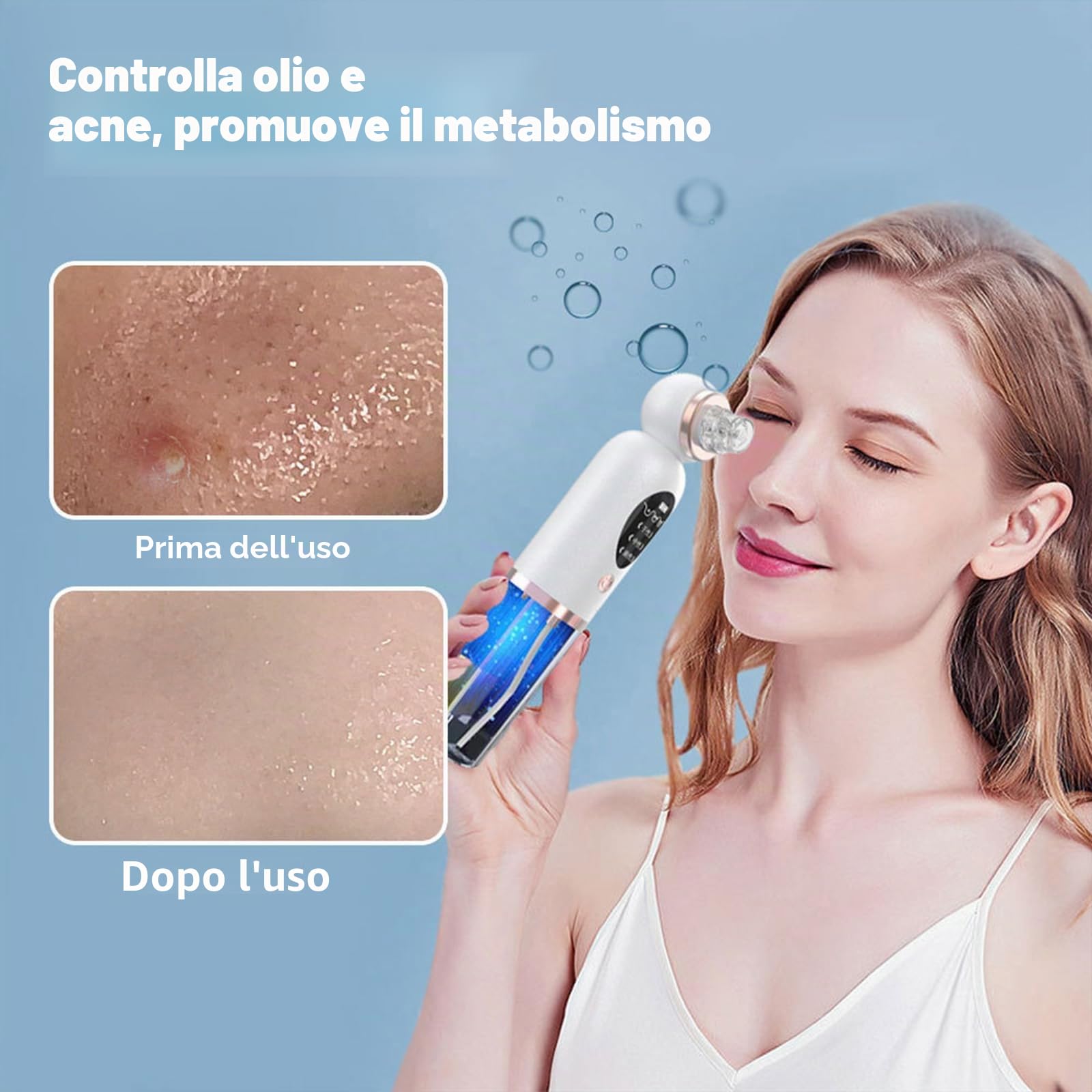 Aspiratore Punti Neri Professionale, Blackhead Remover Vacuum, Pulitore per i punti neri con 6 testine di aspirazione sostituibili per brufoli sottovuoto per la pulizia del viso, acne