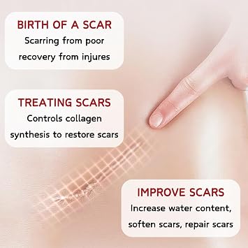 Scar Gel: The ultimate scar - removal remedy for all. Works on every body part, treating old and new scars from acne, surgery, burns, and stretch marks. Its formula smooths, firms, fades scars, and of