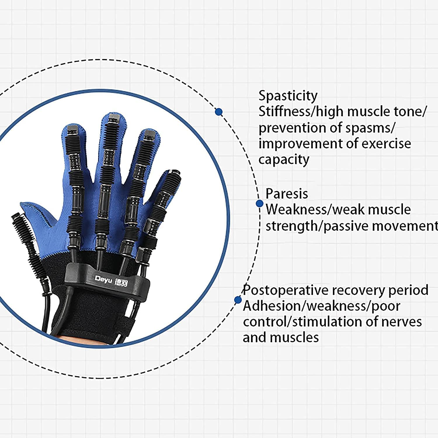 Guantes de robot de rehabilitación, para entrenar la corrección de la flexión de los dedos, ejercicio de extensión de los dedos para pacientes con hemiplejía de accidente cerebrovascular para la
