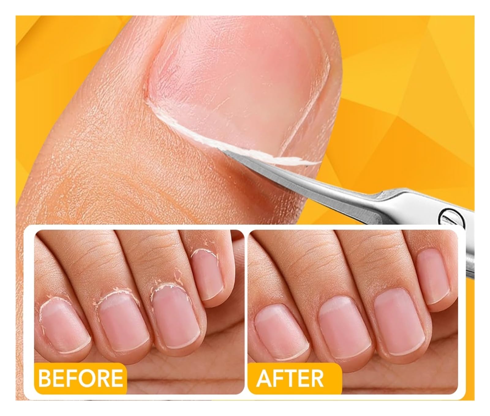 1 Stück Nagelhautschere Nipper Abgestorbene Haut Schere Edelstahl Maniküre Pediküre Werkzeuge Tragbarer Peeling Nagel Trimmer(Multi)