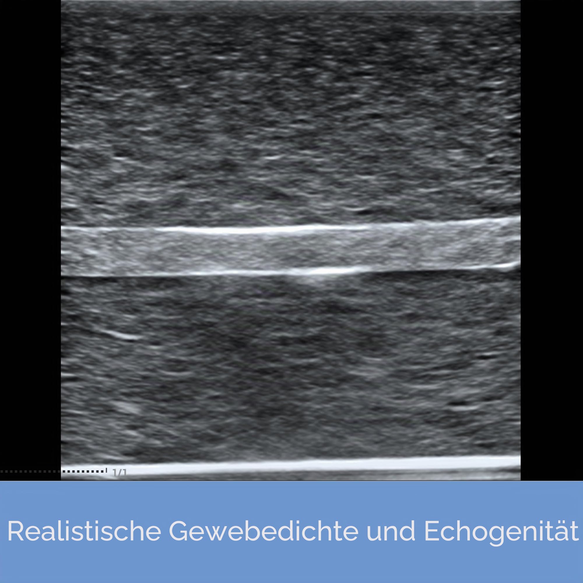 Ultraschall-Phantom-Trainingsmodell für die medizinische Praxis, Nervenblocksimulation (Nervenmodell)