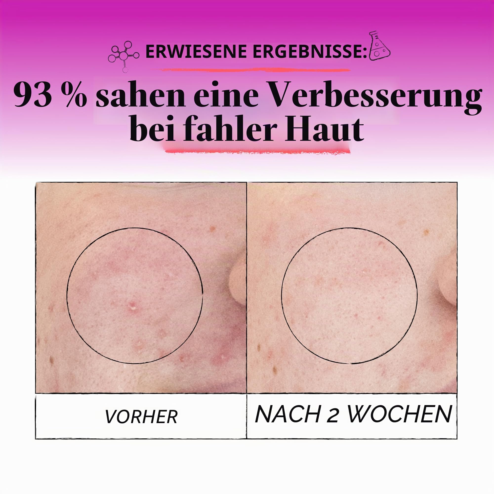 Derma E Microdermabrasions-Peeling 56 g