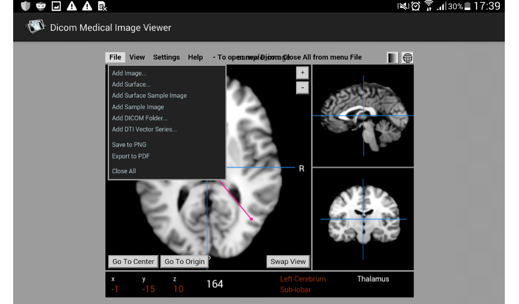 Dicom Medical Image Viewer - App on Amazon Appstore