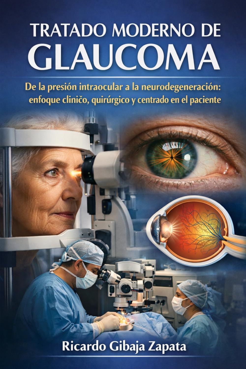 TRATADO MODERNO DE GLAUCOMA De la presión intraocular a la neurodegeneración: enfoque clínico, quirúrgico y centrado en el paciente