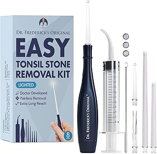 Does A Dentist Remove Tonsil Stones? MedShun