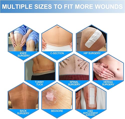 Miniatura 7 de Paquete de 30 apósitos adhesivos impermeables de 4" x 8" para recuperación posquirúrgica  Vendajes de gasa estériles con borde y almohadilla