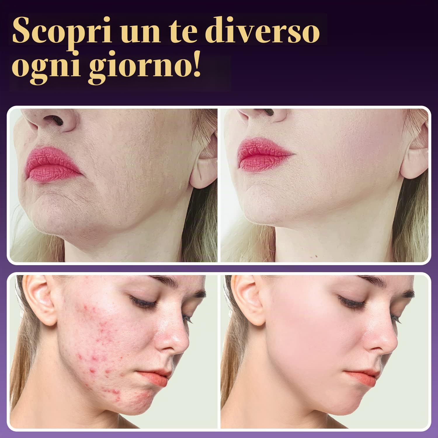 TUMAKOU Alta Frequenza Viso Professionale - 6 in 1 Viola Elettroterapia | Massaggiatore Facciale per Rughe, Rafforzamento della pelle, Rimozione dell'Acne, Linee Sottili, Gli Occhi
