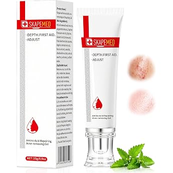 Anti Pickel Gel 25g Gesichtspflege Akne-Creme Linderung von R tungen  lkontrolle Skincare Screme Akne Gel Reduziert Hautunreinheiten und Pickel beruhigt die Haut Sanfte Wirksame