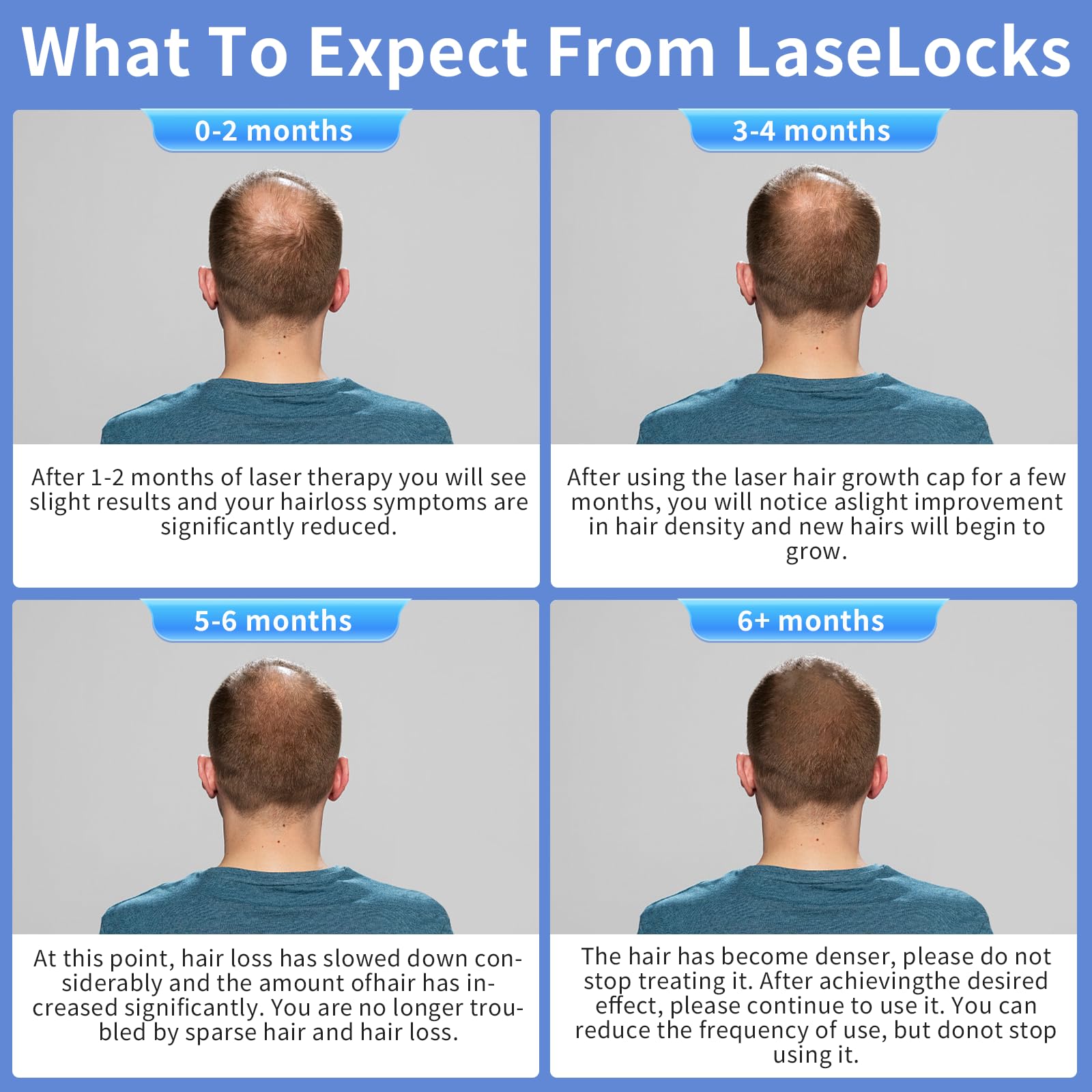 Haarwachstumskappe, kabellose Laserkappe für Haarwachstum, Haar-Lasertherapie für Haarwachstum, Laser-Haarausfall-Behandlung für Männer und Frauen mit Haarausfall und dünner werdendem Haar