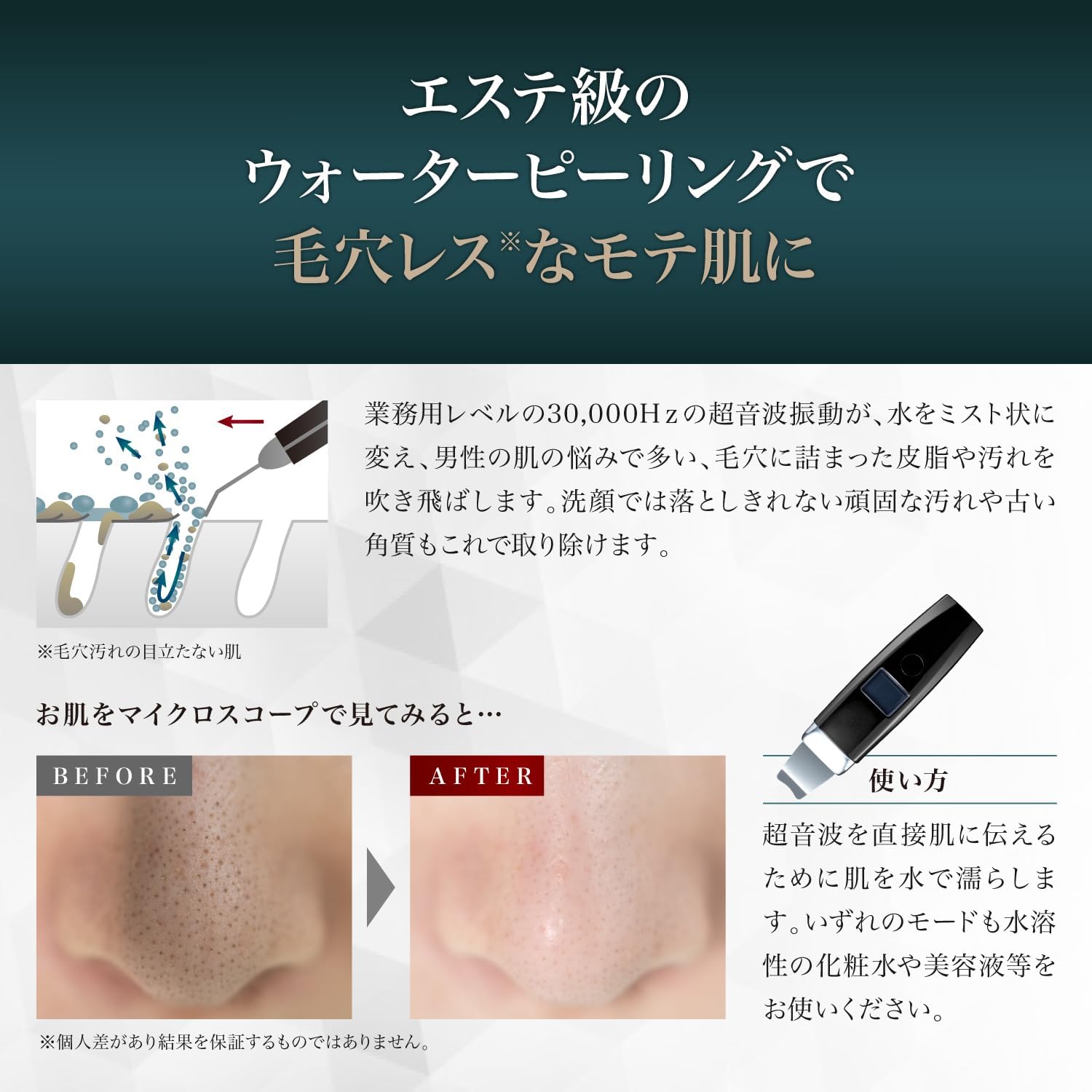 ドクターフレスコフィオン　サロン用毛穴洗浄器 ドクターフレスコフィオン サロン用毛穴洗浄器 【公式通販】