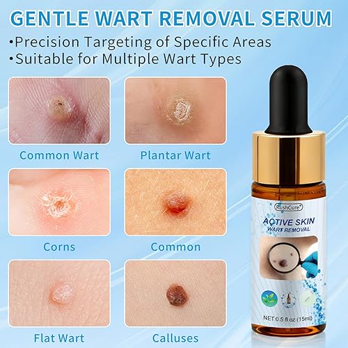 Miniatura 2 de RushCure Eliminación de verrugas cutáneas con 17% de ácido salicílico, suero removedor de lunares con gotero de precisión, removedor de marcas