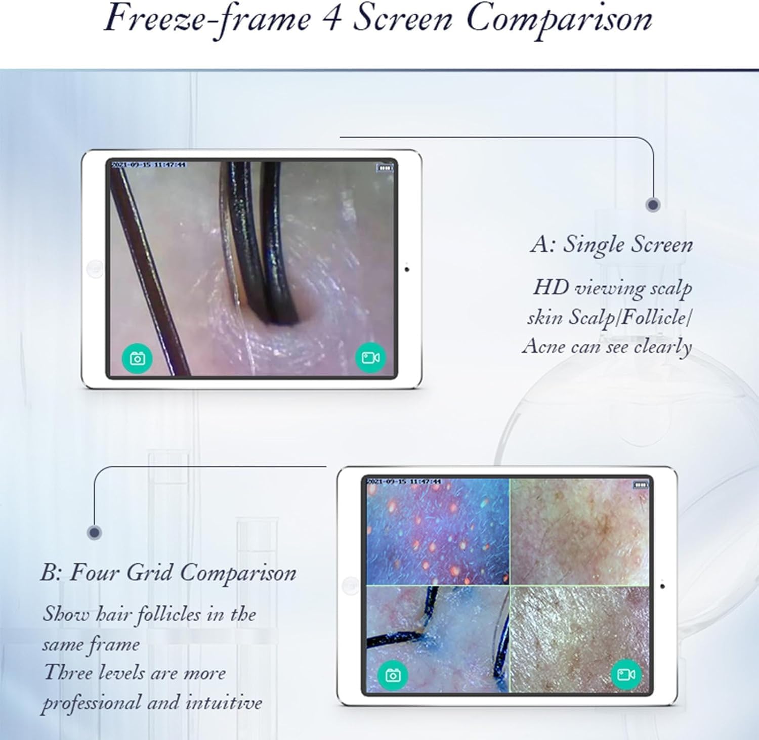 Analizador de piel recargable, escáner de pelo con pantalla LCD, detector digital de humedad y microscopio del cuero cabelludo para belleza y uso doméstico