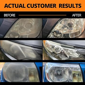 CERAKOTE Ceramic Headlight Restoration Kit To Last As Long As You Own Your Vehicle Brings Headlights Back to Like New Condition - No Power Tools Required - 10 Wipe Kit