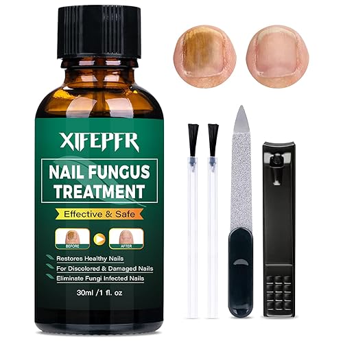 XIFEPFR Tratamiento de reparación de uñas extra fuerte, solución de reparación de uñas para uñas y uñas, líquido de renovación para uñas gruesas y
