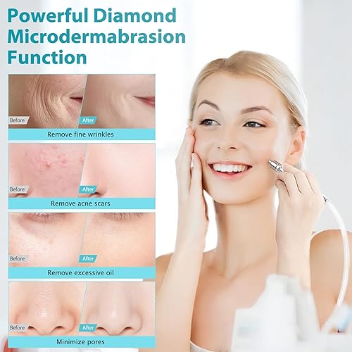 Miniatura 4 de Yofuly Máquina de terapia al vacío, máquina de elevación de glúteos al vacío 3 en 1 con juego de vasos de glúteos de 60.9fl oz, máquina profesional