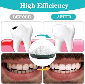 Sukh 10.9oz Moldable False Teeth Beads - Tooth Repair Kit,Repair Thermoplastic Beads,Plastic Pellets for DIY Tooth Filling,Halloween Vampire Teeth Fangs Ideal for Chipped, Cracked