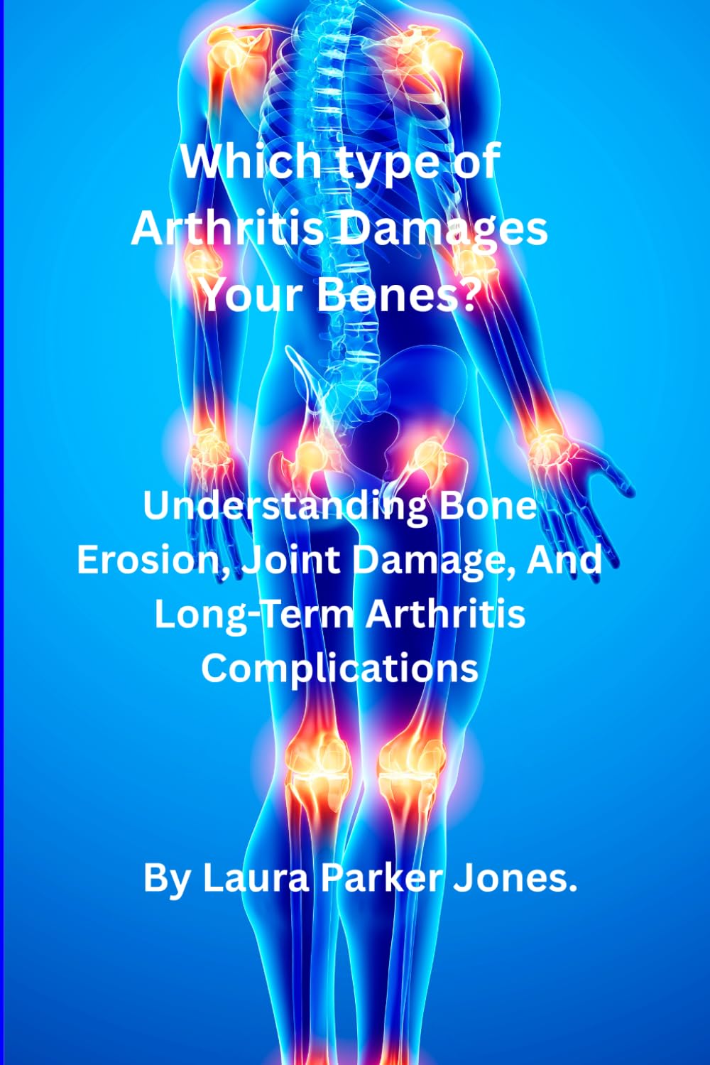 Which Type of Arthritis Damages Your Bones?: Understanding Bone Erosion, Joint Damage & Long-Term Arthritis Complications. (Arthritis and You)