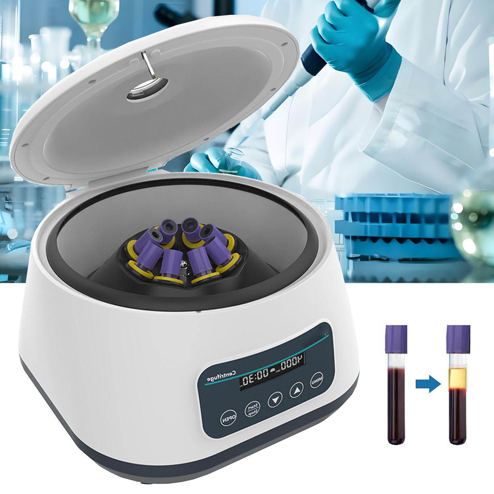 Centrifuga da Banco per Laboratorio PRP 8x2ml/5ml/10ml/15ml capacità Provette, Bassa velocità 500-5000rpm/Min, Max 2683xg RCF, Adatta per Pratica Medica Sangue/Siero/Plasma/Grasso,5000rpm