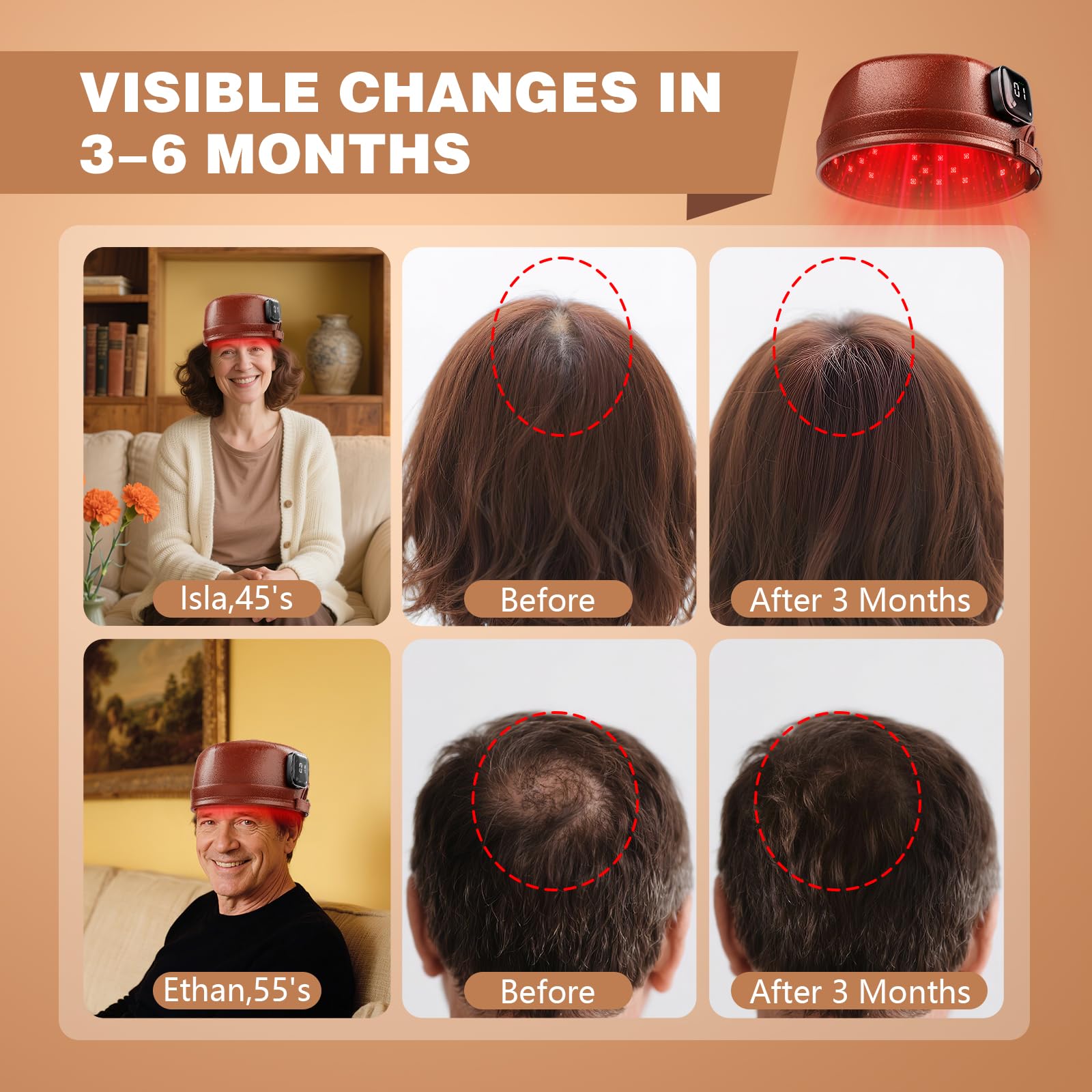 iKeener Red Light Therapy Cap for Hair Regrowth FDA Cleared Wireless Laser Hair Growth Hat with 660nm & 850nm - Image 2