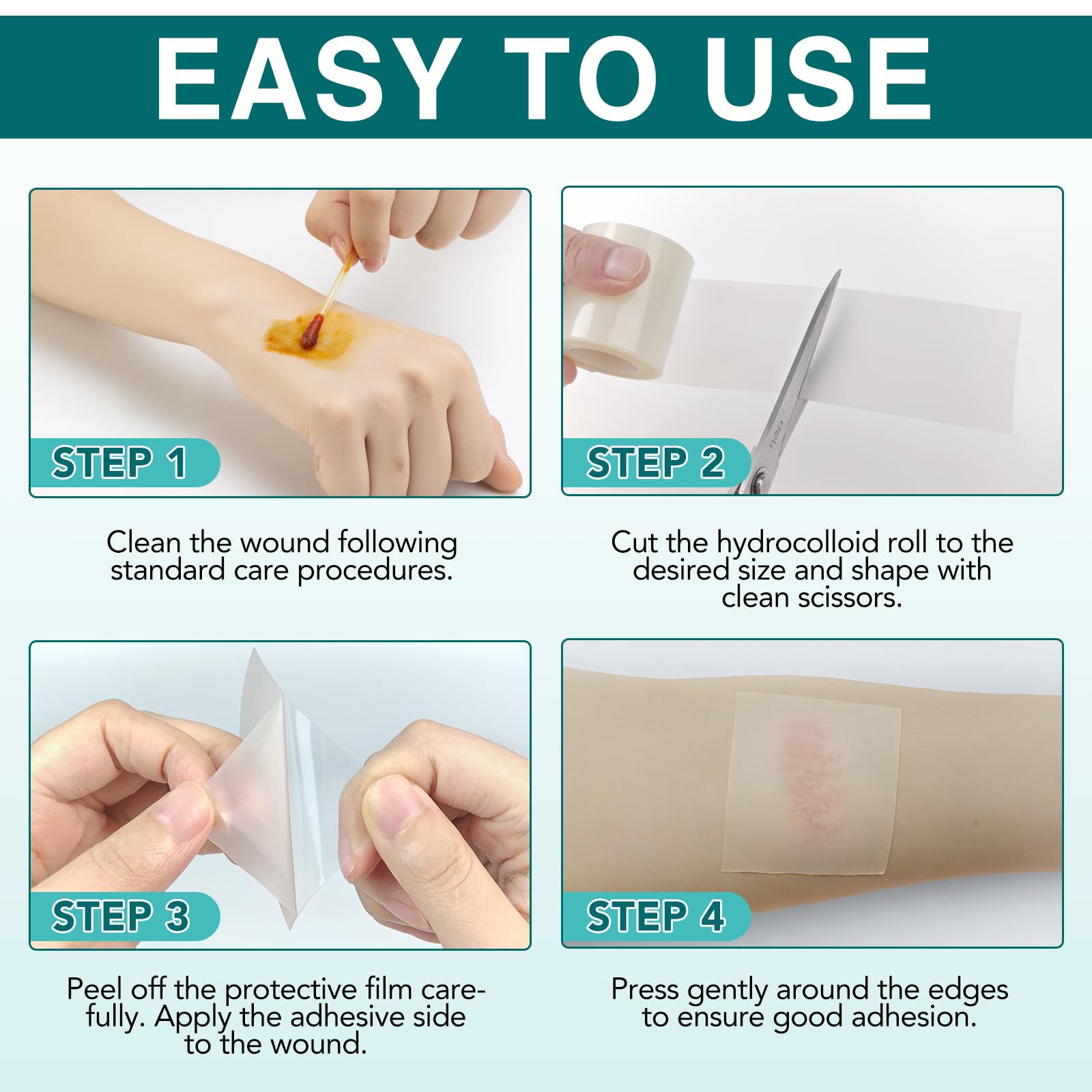 Rollo de Hidrocoloide para el Cuidado de Heridas, 5 cm x 3,6 m, Cinta Impermeable Recortable, Vendaje Autoadhesivo Ultraabsorbente para Ampollas y Acné, Agradable para la Piel.