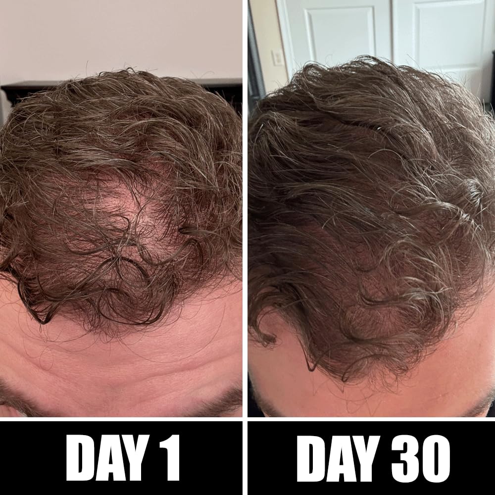 Pete & Pedro BOOST Hair & Beard Strengthening & Growth Natural Scalp Health Serum Oil For Men & Women - With Rosemary, Biotin & 20 plus Essential Oils | Shark Tank Featured, 2 oz. - Image 3