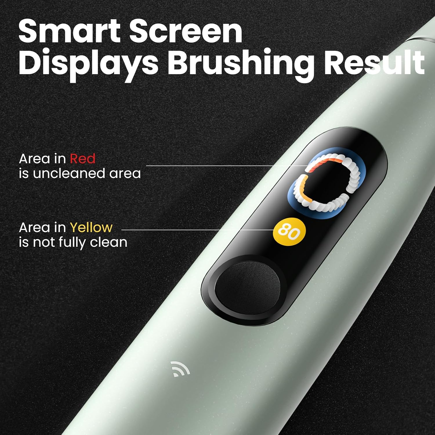 Oclean X Ultra S screen showing brushing results with red and yellow areas