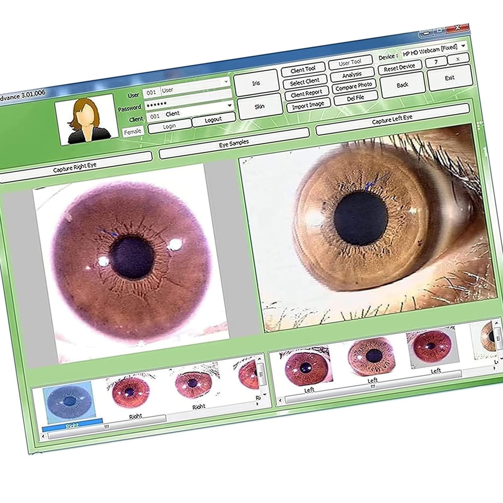 Telecamera iridoscopica medicale,Analizzatore Dell'iride Iridologia,USB iridoscopio Telecamera iridologica,Iris Software per diagnosi Eye