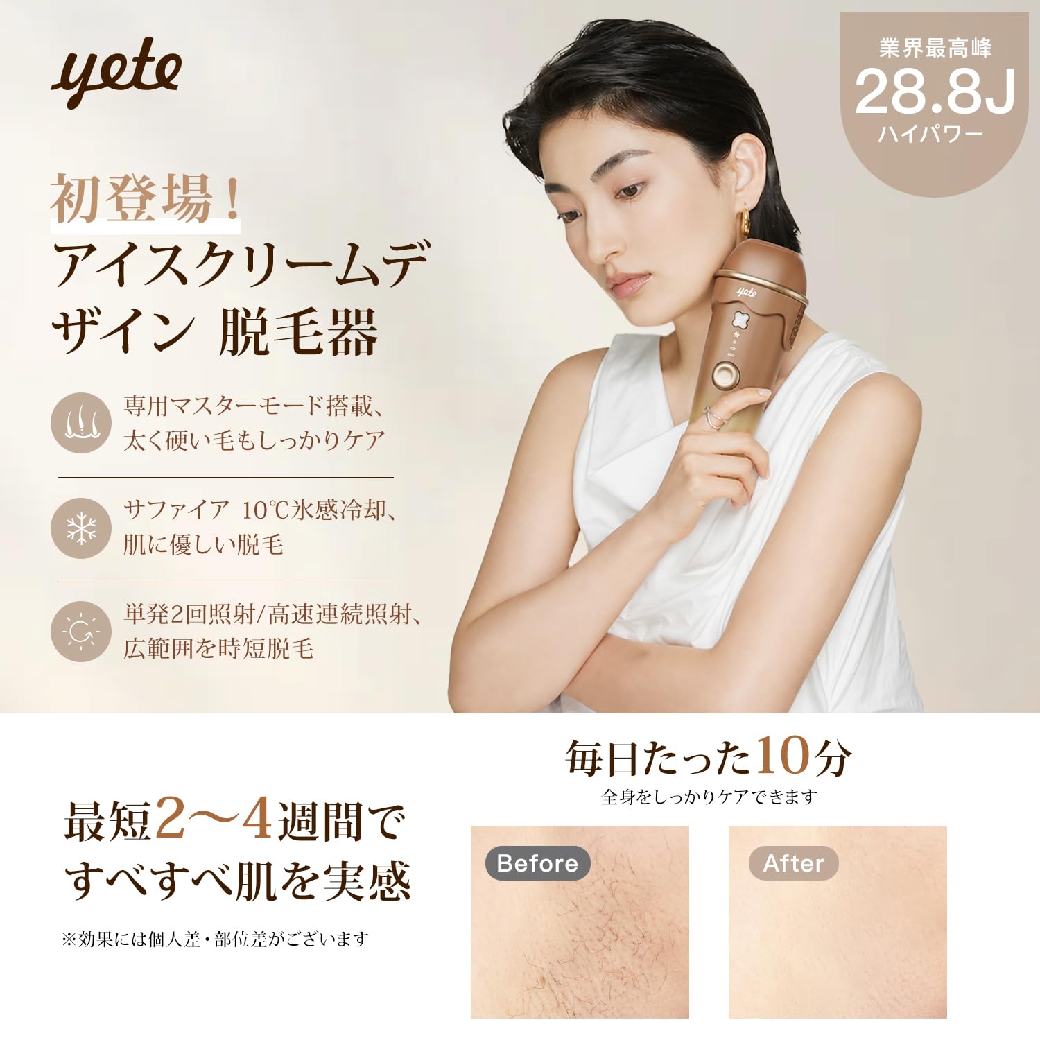 Amazon | YETE 脱毛器 冷感 アイスクリーム脱毛器 10℃恒冷 IPL 湿脱