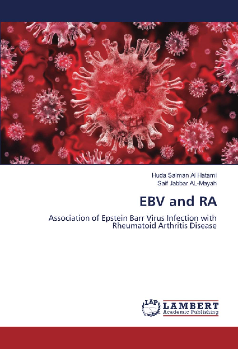EBV and RA