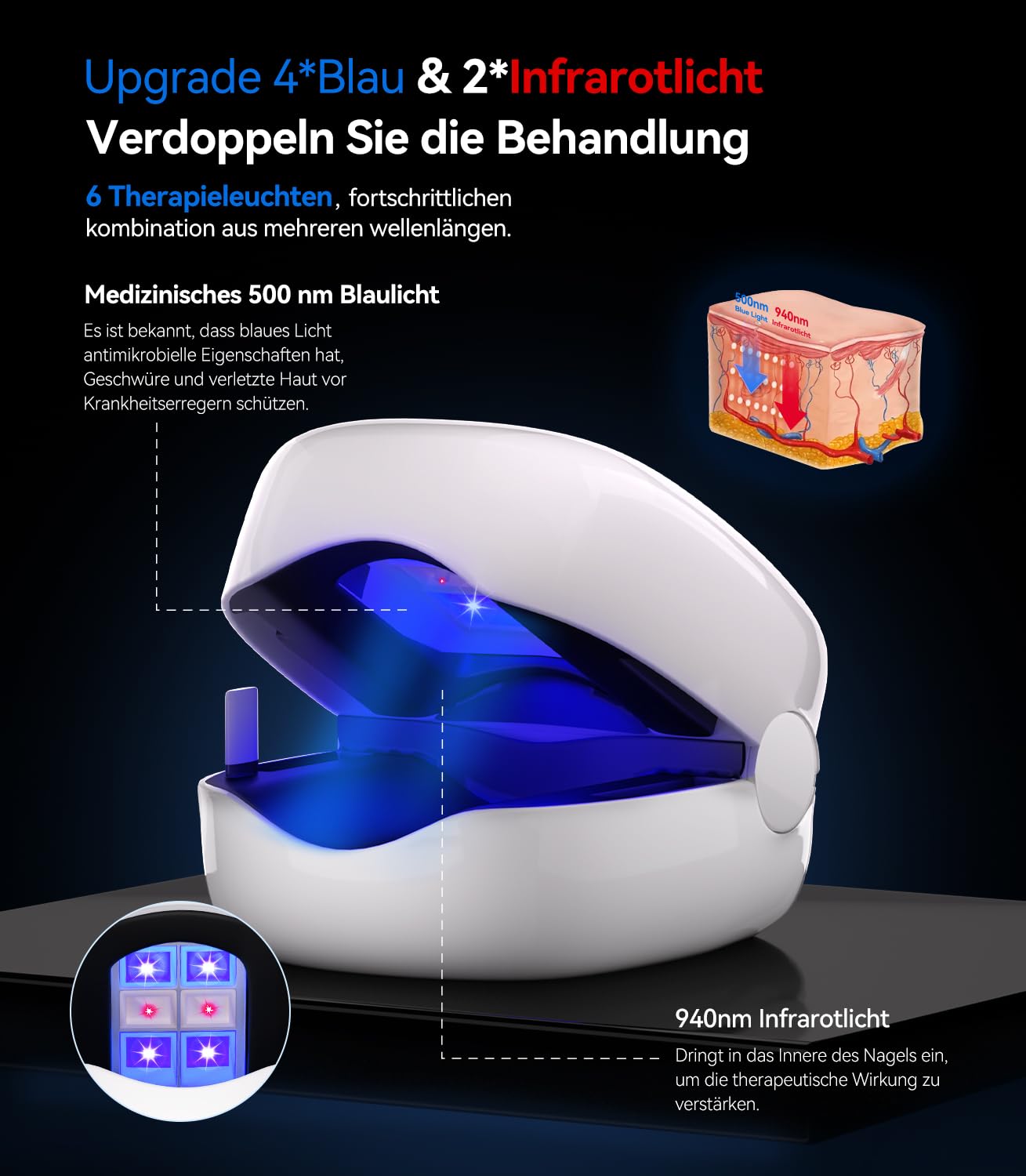 6.0 Upgrade Nagelpilz Lasergerät【Upgrade 4*Blau & 2*Infrarotlicht - Beseitigung von 99,96 Prozent】【mit Zeitanzeige - Nagelpil Lasergerä Antimykotischer】Geeignet für beide Füße/Hände(White)