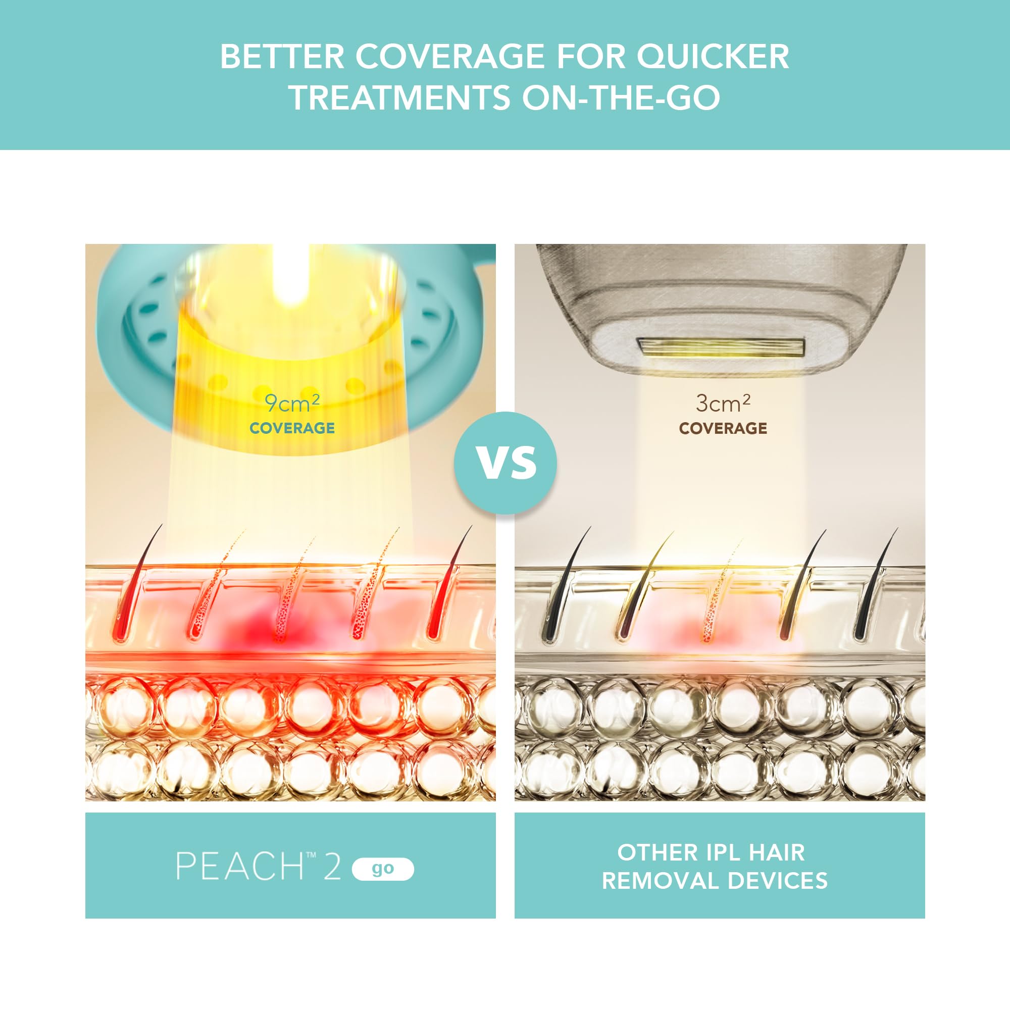 FOREO Peach 2 go IPL Hair Removal Device - Travel-Friendly Permanent Hair Removal - Laser Hair Removal - Body & Face - Painless Hair Removal - Skin Cooling & Silicone Shield - Customizable Artic Blue