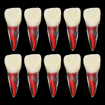 10Pcs Teeth Root Canal Model Endodontic File RCT Practice Pulp for Teaching Study M807 11#