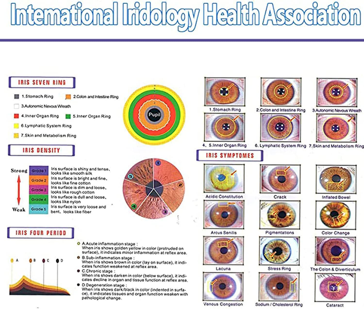 Kamera analizy IRIS,5 milionów pikseli wysokiej rozdzielczości 2560 * 1920 USB2.0 Interfejs Iriscope Diagnostic Eye Camera,z pojedynczym podwójnym sterowaniem lampy regulowaną Win7,Win8, Win10, Win11